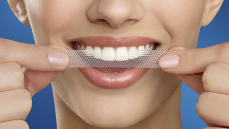 28-Pack Crests 3D Whitestrips Gentle | $20 | Amazon | Clip the $15 coupon